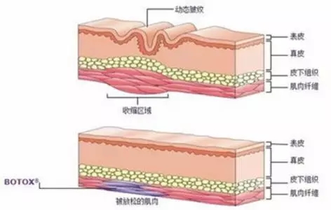 年轻or衰老，只在美莱一线之间